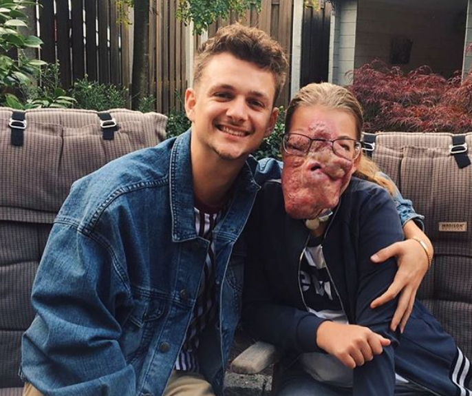 Sven uit Je Zal Het Maar Hebben heeft een seksverzorger